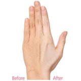 برتي كريم كوري بحمض هيالورونيك لتفتيح 50 جم | صيدلية.كوم.