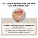 امبولات البقع الداكنة مدغشقر سينتيلا من سكين 1004 | صيدلية.كوم.