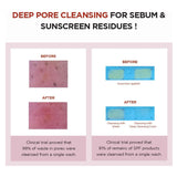 غسول رغوي مدغشقر سينتيلا للتنظيف العميق للمسام 125 مل من سكين 1004 | صيدلية.كوم.