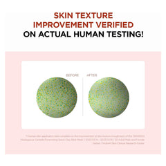 سنتيلا بورمايزنج قناع طين من سكين 1004 27 جم | صيدلية.كوم.