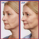 لوريال سيروم ريفيتاليفت بالريتينول النقي ضد التجاعيد 30 مل