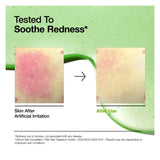 سيروم أزيلايك أسيد 10% وهيالورون 30 مل من انوا |  صيدلية.كوم.