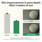 مقشر للمسامات وملئه كريم بحمض LHA 50 مل اكسيس واي |  صيدلية.كوم.