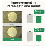 غسول الموغورت لتنقية المسام 100 مل من اكسيس واي |  صيدلية.كوم.