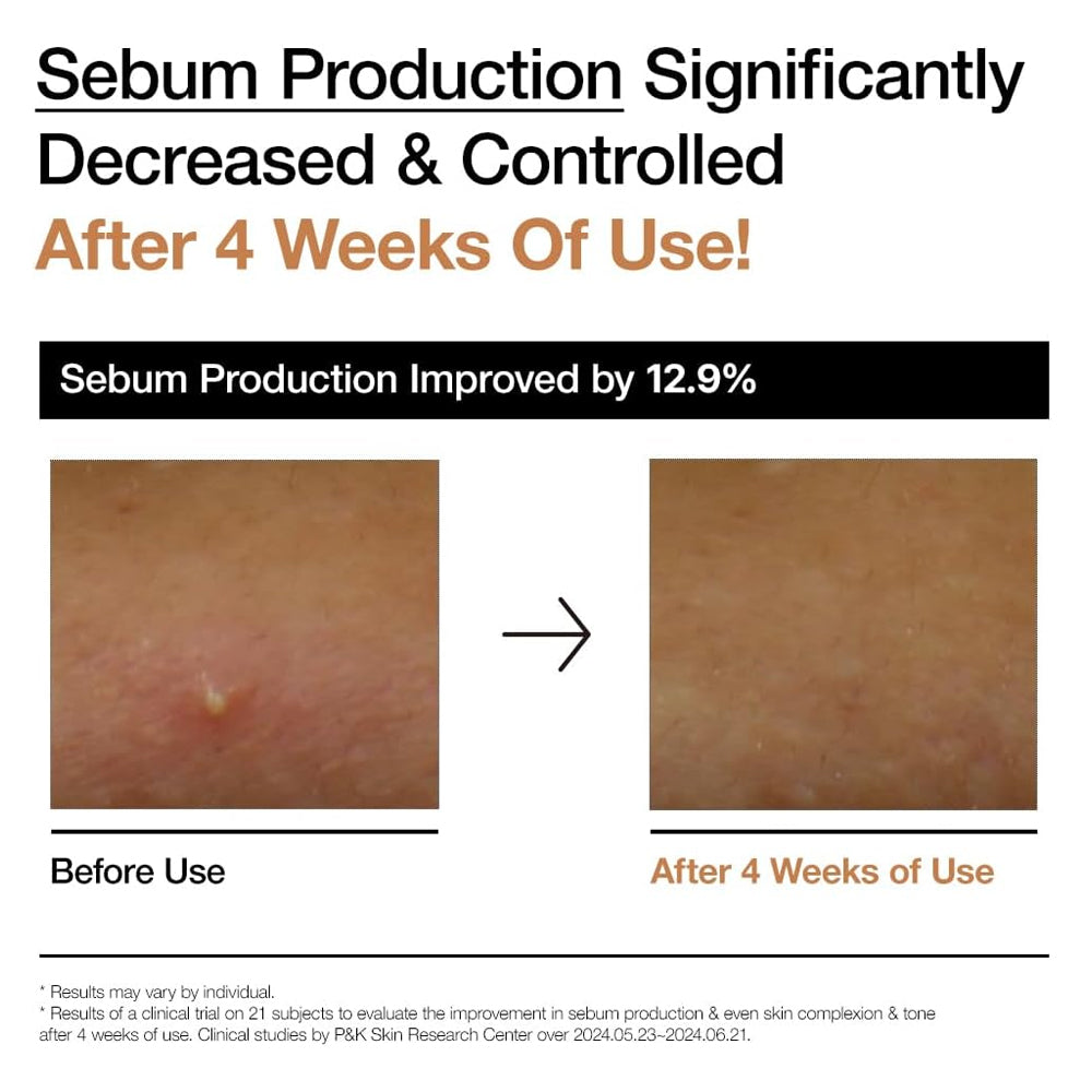 تونر التوهج بخلاصة الأرز من أنوا 250 مل | صيدلية.كوم.