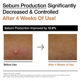 تونر التوهج بخلاصة الأرز من أنوا 250 مل | صيدلية.كوم.