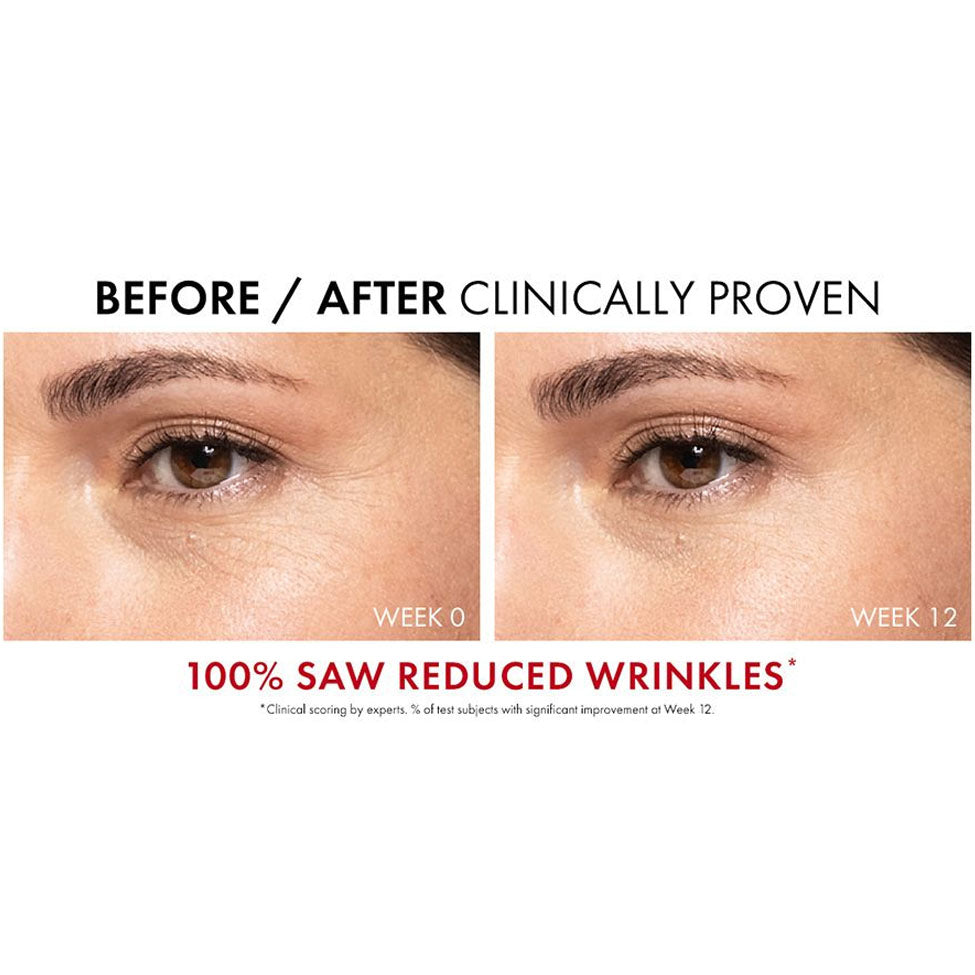 سيروم ليفت اكتيف كولاجين سبيشيليست 16 من فيتشي 30 مل | صيدلية.كوم.