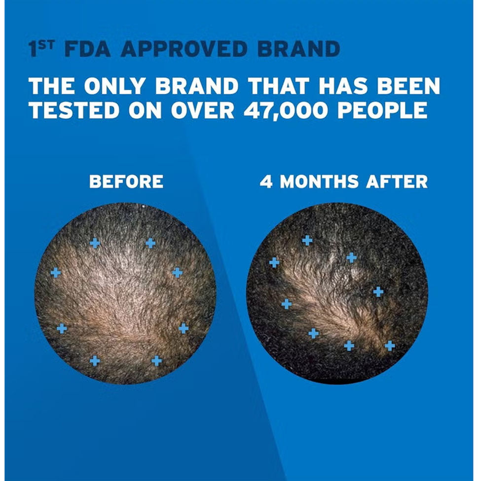 رغوة مينوكسيديل 5٪ نقية للرجال لعلاج تساقط الشعر وإعادة نموه 3 × 60 جم من روجين | صيدلية.كوم.