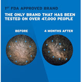 رغوة مينوكسيديل 5٪ نقية للرجال لعلاج تساقط الشعر وإعادة نموه 3 × 60 جم من روجين | صيدلية.كوم.