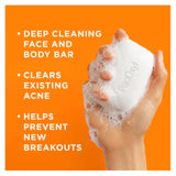 PanOxyl Acne Treatment Bar 10% Benzoyl Peroxide 113 g