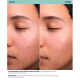 سوسكن سيروم مضاد للشوائب 15 مل