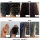 زيت محاسن الشعر 200 مل