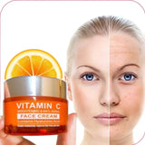 إيفر استار كريم فيتامين C وحمض الهيالورونيك