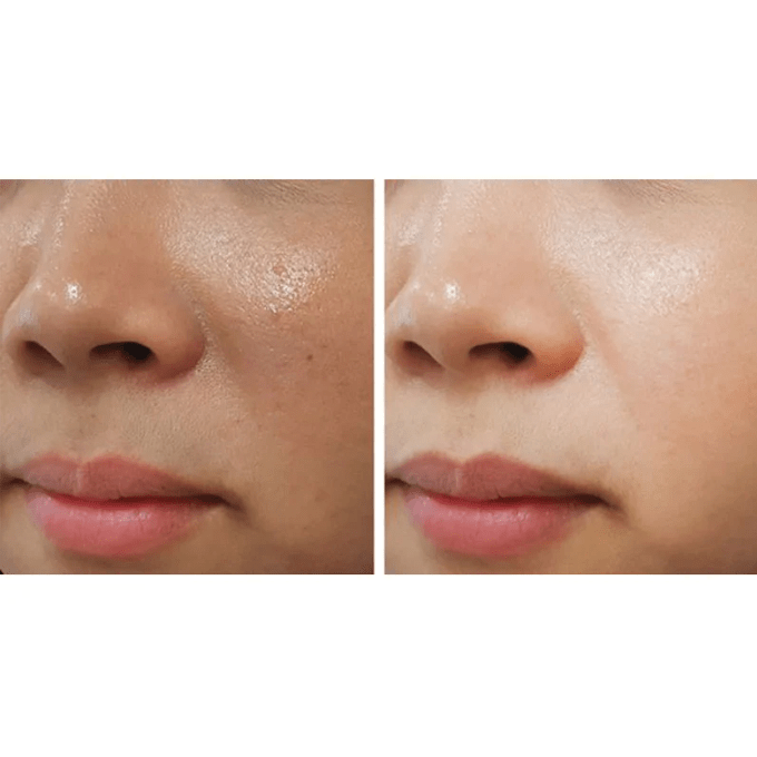 كريم ACM لتوحيد لون البشرة وتقليل إنتاج الميلانين - 40 مل