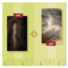 Ashry Natural Karma Tonic Extra Hair Loss Treatment Spray 125 ml