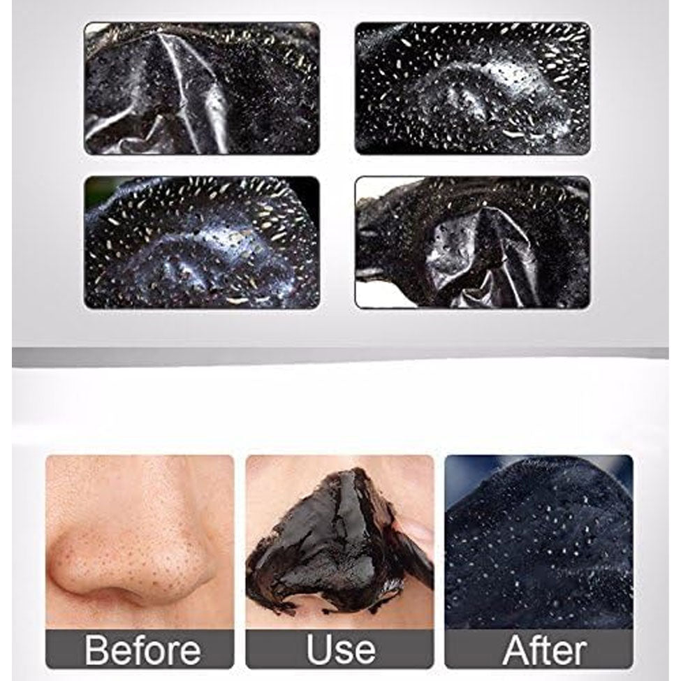 قناع الوجه بالفحم الأسود و الكولاجين 100 مل من دكتور راشيل | صيدلية.كوم.