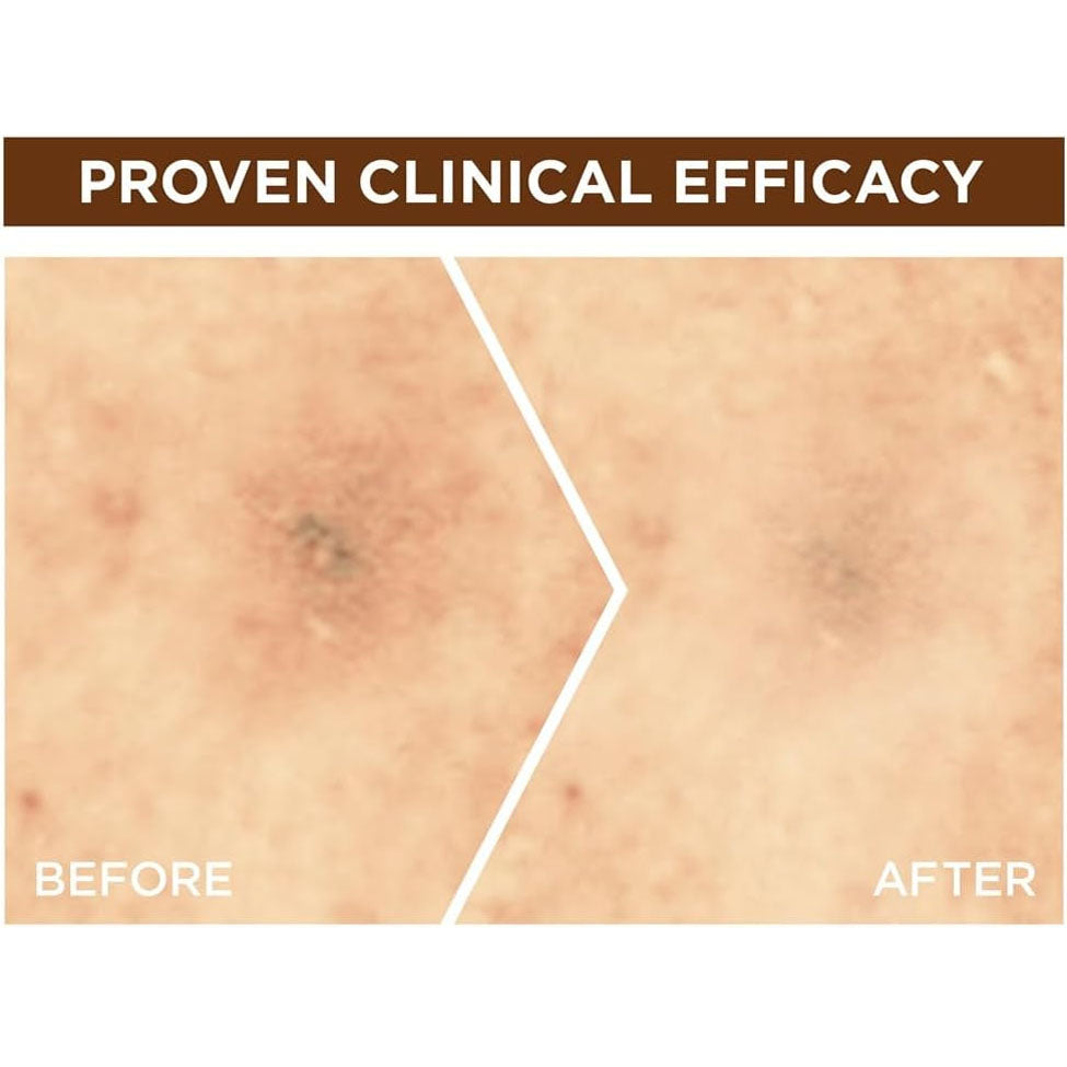 3- سيروم البقع الداكنة جارنييه للوجه اشراقه سريعة فيتامين سي