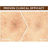 3- سيروم البقع الداكنة جارنييه للوجه اشراقه سريعة فيتامين سي