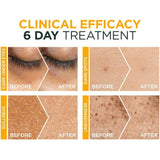 غارنييه 3 ٪ أمبول فيتامين سي نياسيناميد 1.5 مل × 12 قطعة