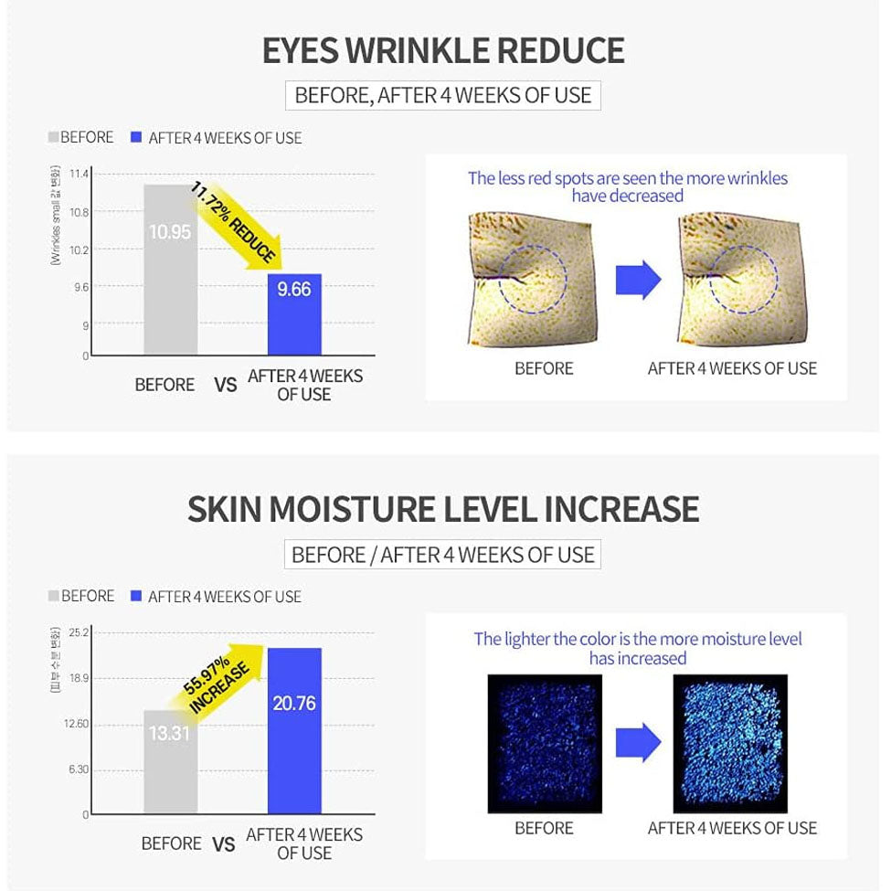 ام سوري فور ماي سكين أمبولة كريم