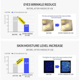 ام سوري فور ماي سكين أمبولة كريم