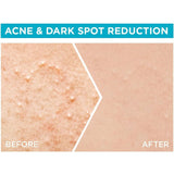 Garnier Facial Serum Rapid Purification Vitamin C for acne-prone skin 30 ml