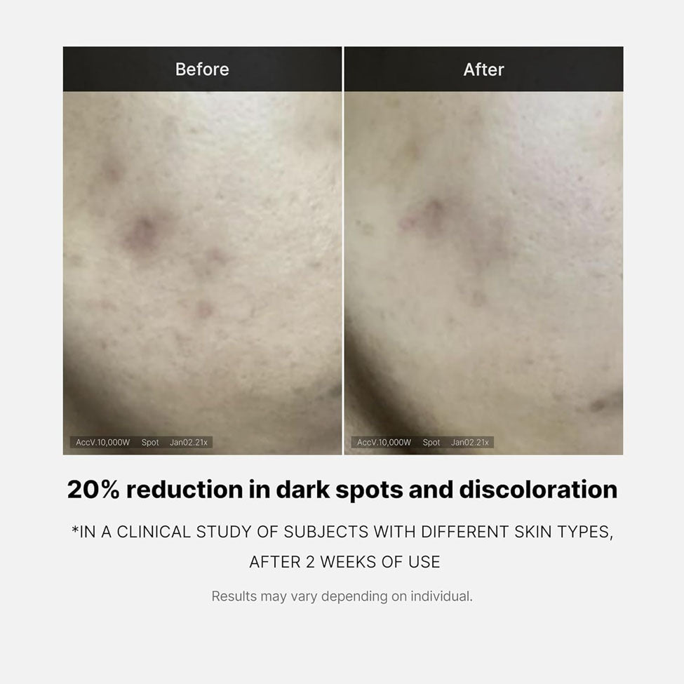 3- ميديكيوب أمبولة فيتامين سي المركز لتحسين لون البشرة وإزالة التصبغات وندبات حب الشباب 3 أمبولات