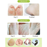 Purederm Shiny & Soft Foot Peeling Mask