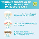 غارنييه سيروم للوجه فيتامين سي 15 مل