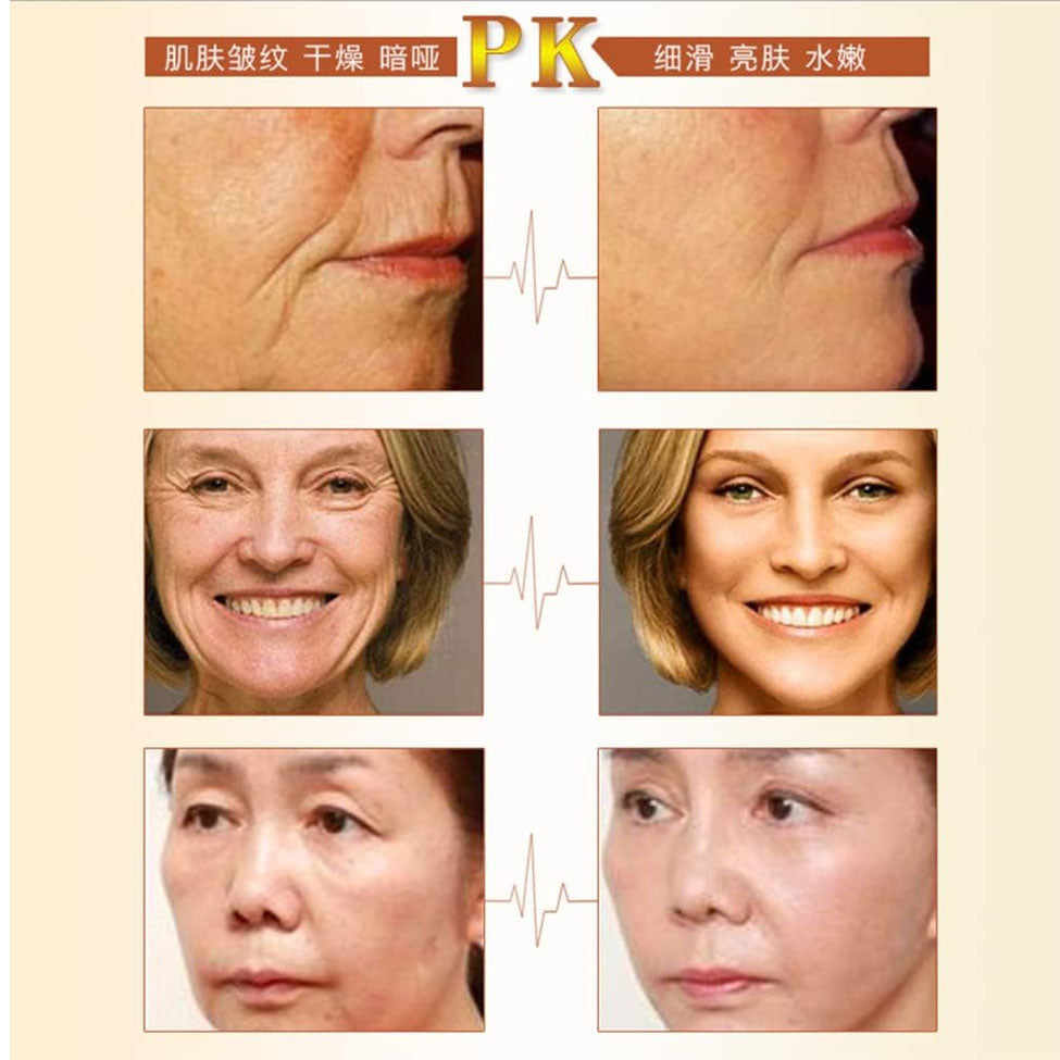 6- ايتشون قناع مُبيض قابل للتقشير بالكافيار والذهب 120مل