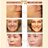 6- ايتشون قناع مُبيض قابل للتقشير بالكافيار والذهب 120مل