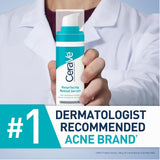 سيرافي سيروم وجه ريتينول لعلامات ما بعد حب الشباب