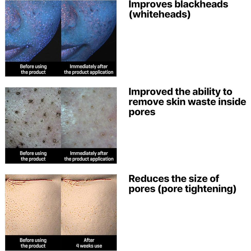 منظف وجه زيتيلاكتو الصويا من سوم باي مي 200 مل | صيدلية.كوم.