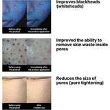 منظف وجه زيتيلاكتو الصويا من سوم باي مي 200 مل | صيدلية.كوم.