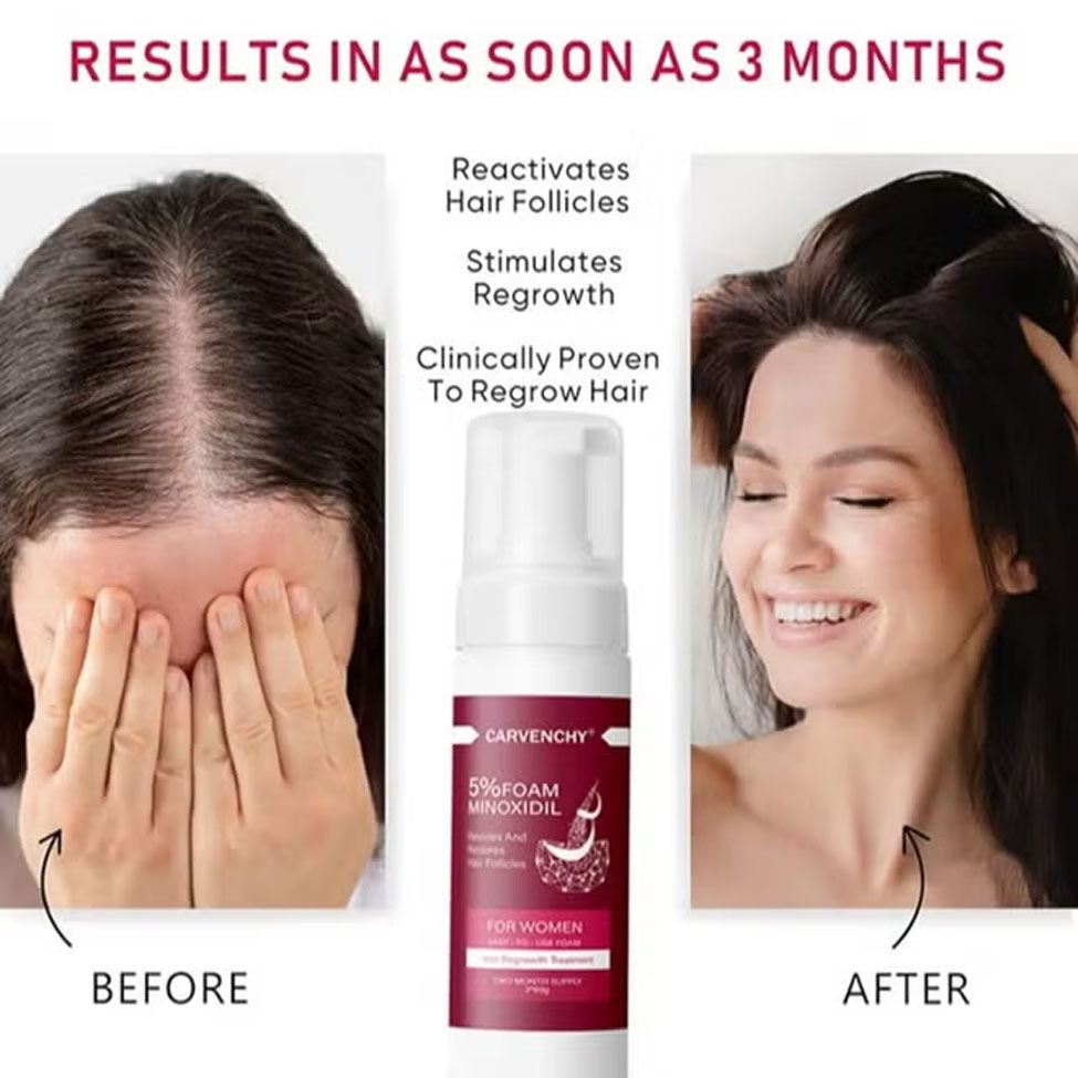 كارفينشي مينوكسيديل رغوة 5% لعلاج تساقط الشعر 60 مل ×2 | صيدلية.كوم.