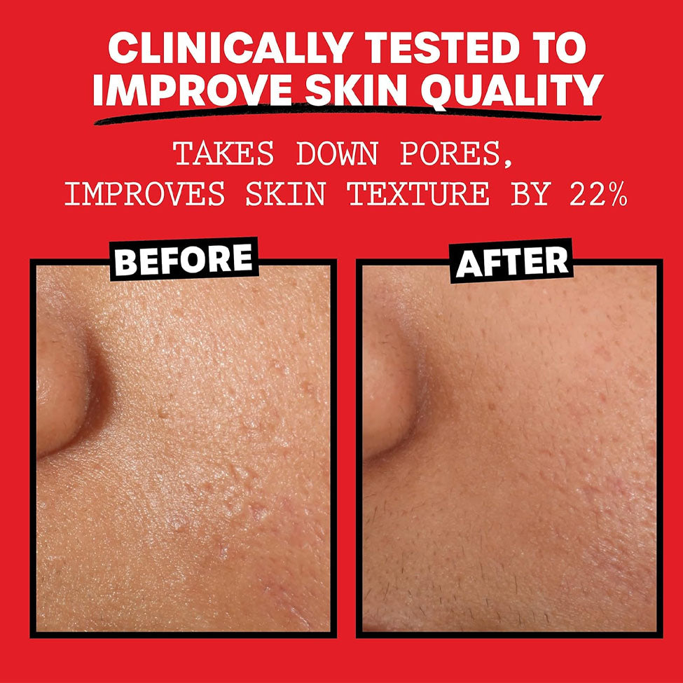 تونر للوجه بتلات الورد 355 مل من ثايرز | صيدلية.كوم.