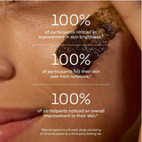 أكيور مقشر الوجه لتفتيح البشرة 118 مل