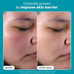 باولاز تشويس محلول مقشر 118 مل