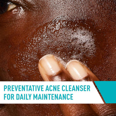 CeraVe Acne Control Cleanser 237 ml