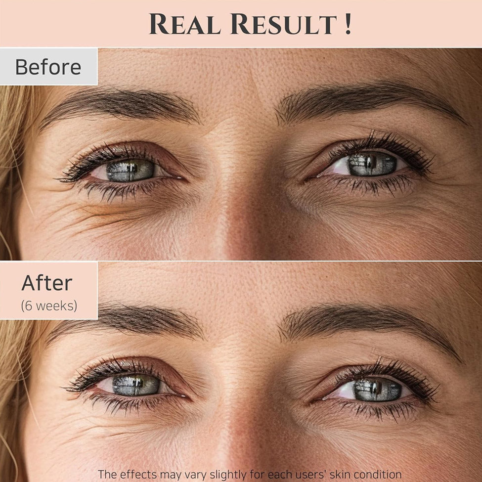 بيوتي اوف جوسون كريم لشد العين بالريتينول والجينسنغ 30 مل | صيدلية.كوم.