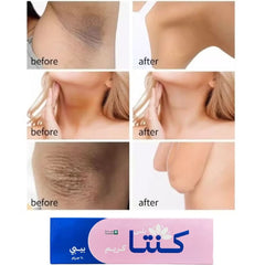 كنتا بلس كريم لتهدئة وتفتيح البشرة