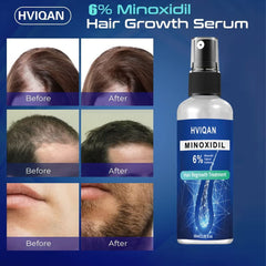 3- افضل انواع المعالجات للشعر ونموه للجنسين هفيكان بخاخ مينوكسيديل 6% 60 مل