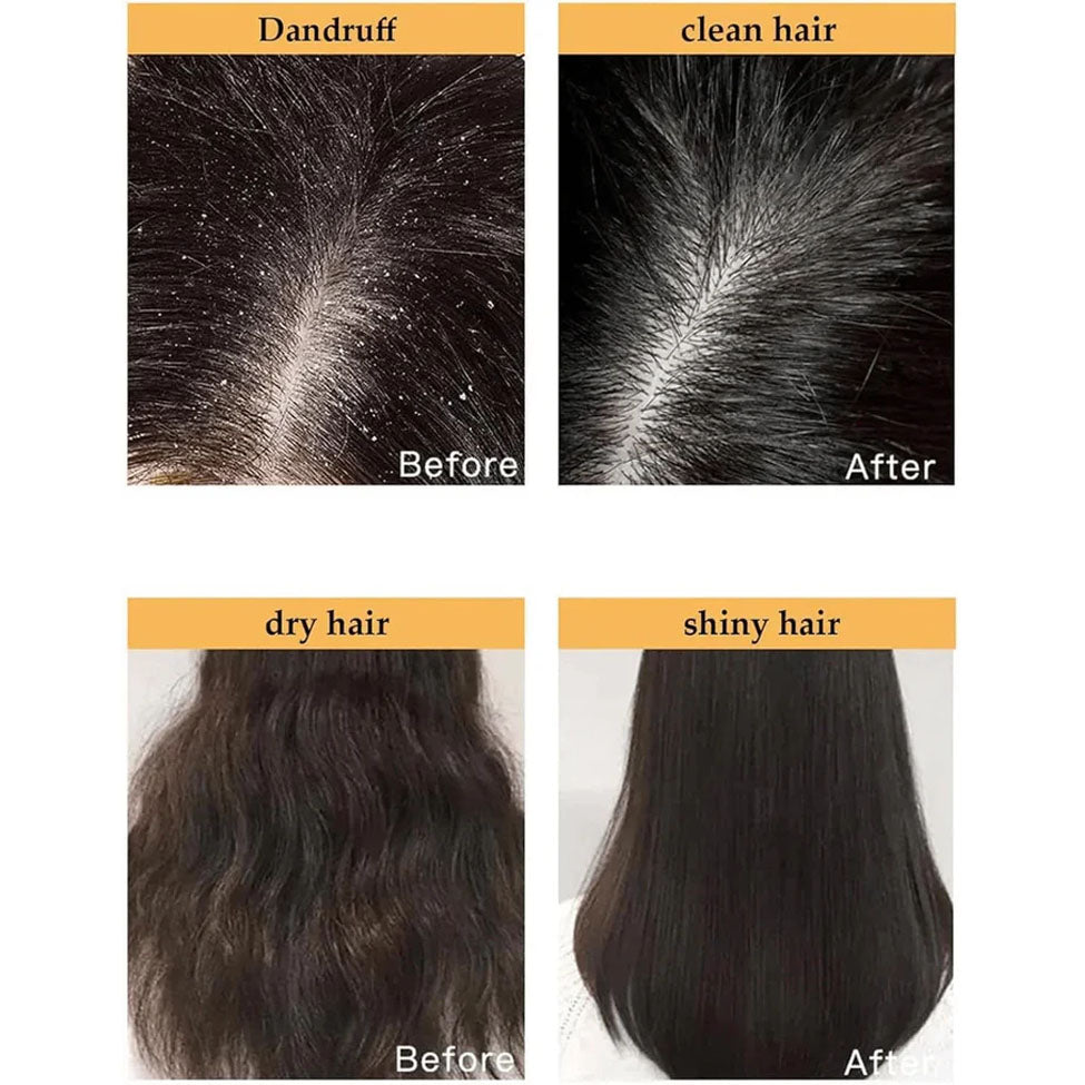 بلسم تساقط الشعر ونموه والقشرة بلسم ساكورا الياباني 300 مل من ماكسفيت |  صيدلية.كوم.