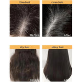 بلسم تساقط الشعر ونموه والقشرة بلسم ساكورا الياباني 300 مل من ماكسفيت |  صيدلية.كوم.