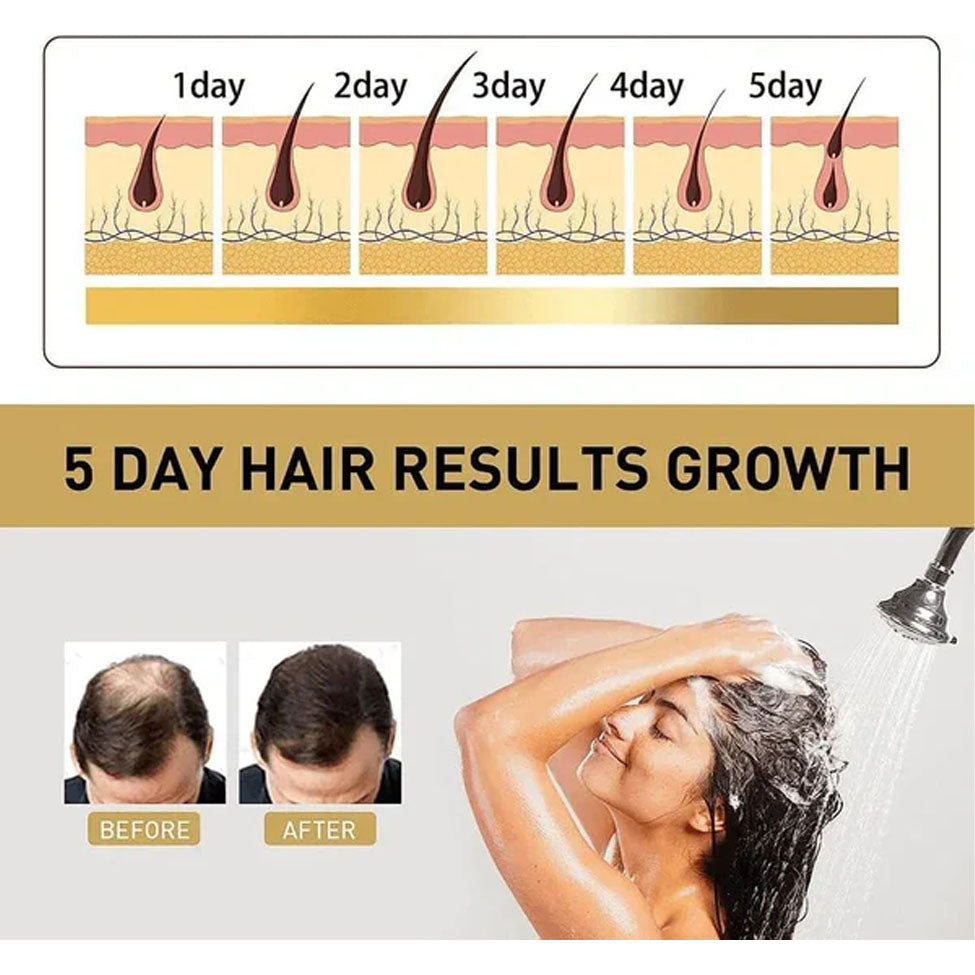 بلسم تساقط الشعر ونموه والقشرة بلسم ساكورا الياباني 300 مل من ماكسفيت |  صيدلية.كوم.