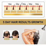 بلسم تساقط الشعر ونموه والقشرة بلسم ساكورا الياباني 300 مل من ماكسفيت |  صيدلية.كوم.