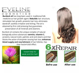 Eveline Bio Organic Burdock Therapy Bioactive Shampoo Preventing Hair Loss 400 ml