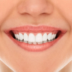 فيتي دينت كريم الاسنان لاصق لاطقم الاسنان مقاوم للماء في 2 - 40 جرام