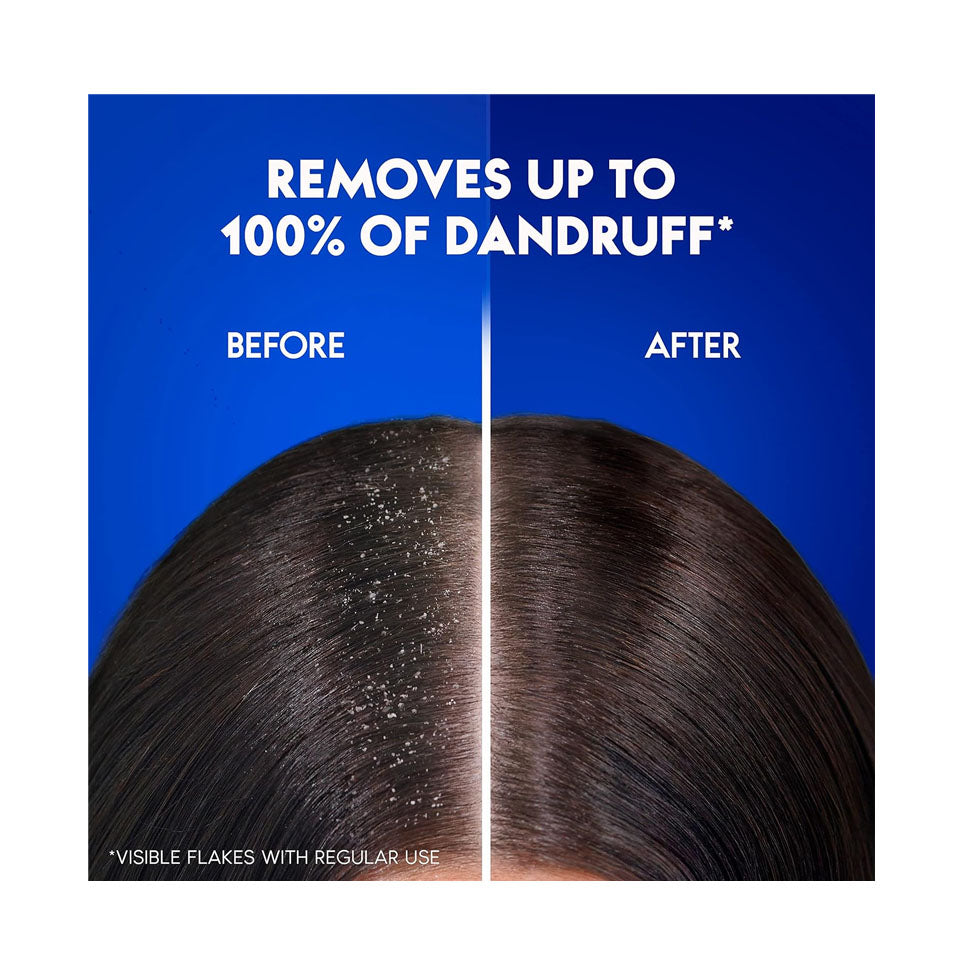 هيد اند شولدرز شامبو تفاح ضد القشرة