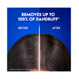 هيد اند شولدرز شامبو تفاح ضد القشرة